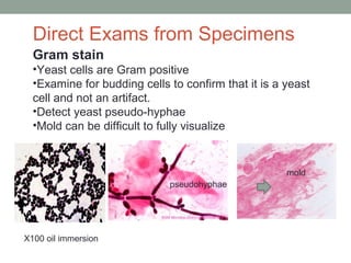 Gram stain
•Yeast cells are Gram positive
•Examine for budding cells to confirm that it is a yeast
cell and not an artifact.
•Detect yeast pseudo-hyphae
•Mold can be difficult to fully visualize
pseudohyphae
mold
pseudohyphae
Direct Exams from Specimens
X100 oil immersion
 