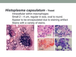 Histoplasma capsulatum - Yeast
Intracellular within macrophages
Small 2 – 4 um, regular in size, oval to round.
Appear to be encapsulated due to staining artifact
Stains with a variety of stains.
H & E PAS
Gram Wrights
 