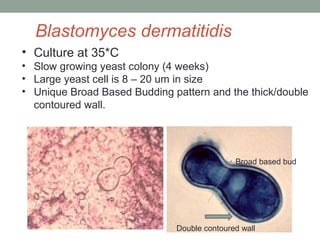 • Culture at 35*C
• Slow growing yeast colony (4 weeks)
• Large yeast cell is 8 – 20 um in size
• Unique Broad Based Budding pattern and the thick/double
contoured wall.
Blastomyces dermatitidis
Broad based bud
Double contoured wall
 