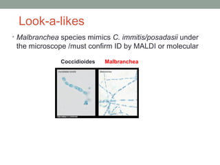 Look-a-likes
• Malbranchea species mimics C. immitis/posadasii under
the microscope /must confirm ID by MALDI or molecular
Coccidioides Malbranchea
 