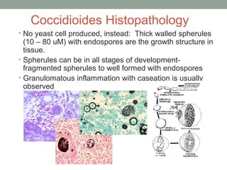 Coccidioides Histopathology
• No yeast cell produced, instead: Thick walled spherules
(10 – 80 uM) with endospores are the growth structure in
tissue.
• Spherules can be in all stages of development-
fragmented spherules to well formed with endospores
• Granulomatous inflammation with caseation is usually
observed
 