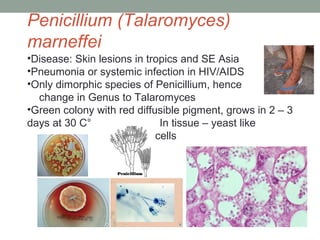 •Disease: Skin lesions in tropics and SE Asia
•Pneumonia or systemic infection in HIV/AIDS
•Only dimorphic species of Penicillium, hence
change in Genus to Talaromyces
•Green colony with red diffusible pigment, grows in 2 – 3
days at 30 C° In tissue – yeast like
cells
Penicillium (Talaromyces)
marneffei
 