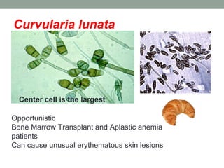Curvularia lunata
Center cell is the largest
Opportunistic
Bone Marrow Transplant and Aplastic anemia
patients
Can cause unusual erythematous skin lesions
 