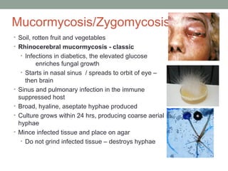 Mucormycosis/Zygomycosis
• Soil, rotten fruit and vegetables
• Rhinocerebral mucormycosis - classic
• Infections in diabet...