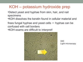•Detect yeast and hyphae from skin, hair, and nail
specimens
•KOH dissolves the keratin found in cellular material and
fre...