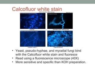 • Yeast, pseudo-hyphae, and mycelial fungi bind
with the Calcofluor white stain and fluoresce
• Read using a fluorescence ...