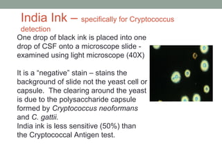 One drop of black ink is placed into one
drop of CSF onto a microscope slide -
examined using light microscope (40X)
It is...