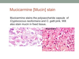 Mucicarmine stains the polysaccharide capsule of
Cryptococcus neoformans and C. gatti pink. Will
also stain mucin in fixed...