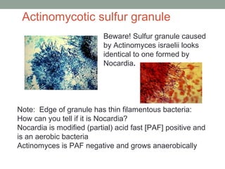 Note: Edge of granule has thin filamentous bacteria:
How can you tell if it is Nocardia?
Nocardia is modified (partial) ac...