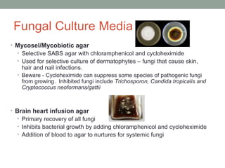Fungal Culture Media
• Mycosel/Mycobiotic agar
• Selective SABS agar with chloramphenicol and cycloheximide
• Used for sel...