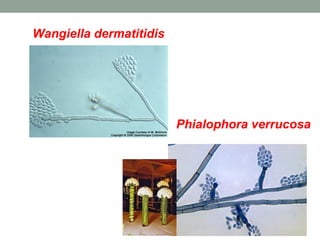 Wangiella dermatitidis
Phialophora verrucosa
 