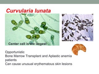 Curvularia lunata
Center cell is the largest
Opportunistic
Bone Marrow Transplant and Aplastic anemia
patients
Can cause u...