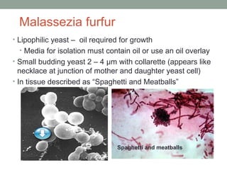 Malassezia furfur
• Lipophilic yeast – oil required for growth
• Media for isolation must contain oil or use an oil overla...