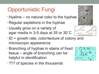 Opportunistic Fungi
• Hyaline – no natural color to the hyphae
• Regular septations in the hyphae
• Usually grow on a vari...