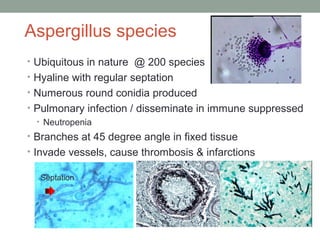 Aspergillus species
• Ubiquitous in nature @ 200 species
• Hyaline with regular septation
• Numerous round conidia produce...