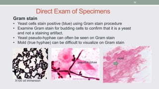 Gram stain
• Yeast cells stain positive (blue) using Gram stain procedure
• Examine Gram stain for budding cells to confir...