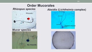 Rhizopus species Absidia (Lichtheimia complex)
Mucor species
No rhizoids
Rhizoids
Order Mucorales
Distant rhizoid
111
 
