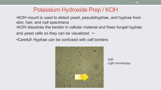 •KOH mount is used to detect yeast, pseudohyphae, and hyphae from
skin, hair, and nail specimens
•KOH dissolves the kerati...