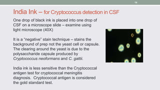 One drop of black ink is placed into one drop of
CSF on a microscope slide – examine using
light microscope (40X)
It is a ...