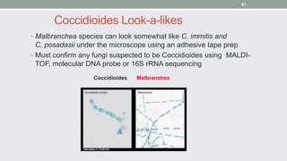 Coccidioides Look-a-likes
• Malbranchea species can look somewhat like C. immitis and
C. posadasii under the microscope us...