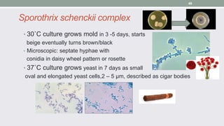 Sporothrix schenckii complex
• 30˚C culture grows mold in 3 -5 days, starts
beige eventually turns brown/black
• Microscop...