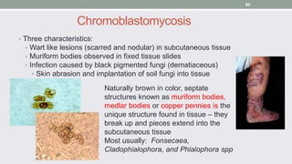 Chromoblastomycosis
• Three characteristics:
• Wart like lesions (scarred and nodular) in subcutaneous tissue
• Muriform b...