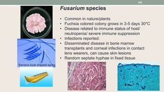 Fusarium species
• Common in nature/plants
• Fuchsia colored colony grows in 3-5 days 30*C
• Disease related to immune status of host/
neutropenia/ severe immune suppression
• Infections reported:
• Disseminated disease in bone marrow
transplants and corneal infections in contact
lens wearers, can cause skin lesions
• Random septate hyphae in fixed tissue
Banana boat shaped spore
105
 