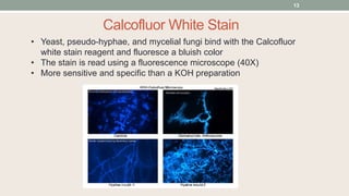 • Yeast, pseudo-hyphae, and mycelial fungi bind with the Calcofluor
white stain reagent and fluoresce a bluish color
• The stain is read using a fluorescence microscope (40X)
• More sensitive and specific than a KOH preparation
Calcofluor White Stain
13
 