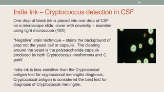 One drop of black ink is placed into one drop of CSF
on a microscope slide, cover with coverslip – examine
using light mic...