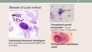 Leishmania donovani amastigote
Note: kinetoplast (mitochondrial DNA) next
to nucleus
Toxoplasma gondii
tachyzoites - Oval ...