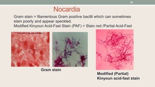Gram stain = filamentous Gram positive bacilli which can sometimes
stain poorly and appear speckled.
Modified Kinyoun Acid-Fast Stain (PAF) = Stain red /Partial Acid-Fast
Modified (Partial)
Kinyoun acid-fast stain
Gram stain
Nocardia
55
 