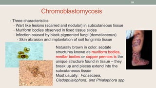 Chromoblastomycosis
• Three characteristics:
• Wart like lesions (scarred and nodular) in subcutaneous tissue
• Muriform bodies observed in fixed tissue slides
• Infection caused by black pigmented fungi (dematiaceous)
• Skin abrasion and implantation of soil fungi into tissue
Naturally brown in color, septate
structures known as muriform bodies,
medlar bodies or copper pennies is the
unique structure found in tissue – they
break up and pieces extend into the
subcutaneous tissue
Most usually: Fonsecaea,
Cladophialophora, and Phialophora spp
59
 