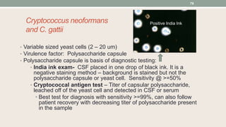 Cryptococcus neoformans
and C. gattii
• Variable sized yeast cells (2 – 20 um)
• Virulence factor: Polysaccharide capsule
• Polysaccharide capsule is basis of diagnostic testing:
• India ink exam- CSF placed in one drop of black ink. It is a
negative staining method – background is stained but not the
polysaccharide capsule or yeast cell. Sensitivity @ >=50%
• Cryptococcal antigen test – Titer of capsular polysaccharide,
leached off of the yeast cell and detected in CSF or serum
• Best test for diagnosis with sensitivity >=99%, can also follow
patient recovery with decreasing titer of polysaccharide present
in the sample
79
Positive India Ink
 
