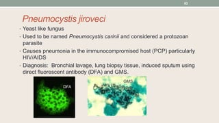 Pneumocystis jiroveci
• Yeast like fungus
• Used to be named Pneumocystis carinii and considered a protozoan
parasite
• Ca...