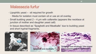 Malassezia furfur
• Lipophilic yeast – oil required for growth
• Media for isolation must contain oil or use an oil overla...