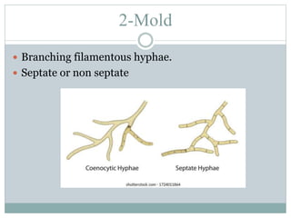 2-Mold
 Branching filamentous hyphae.
 Septate or non septate
 