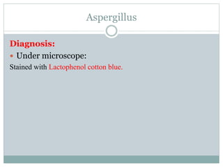 Aspergillus
Diagnosis:
 Under microscope:
Stained with Lactophenol cotton blue.
 