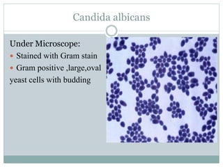 Candida albicans
Under Microscope:
 Stained with Gram stain
 Gram positive ,large,oval
yeast cells with budding
 