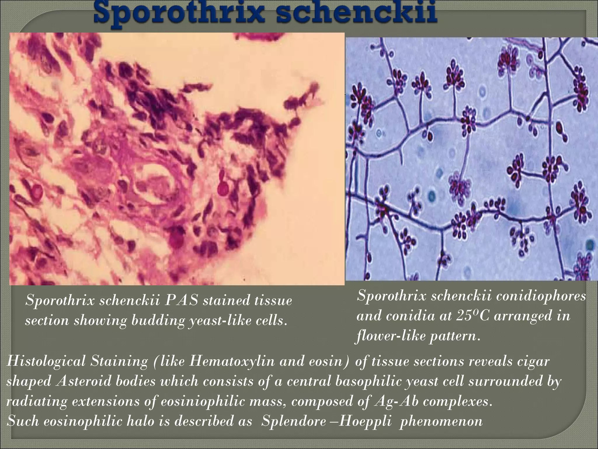 Histopathological Diagnosis of Fungal Infections of 21st century | PPT