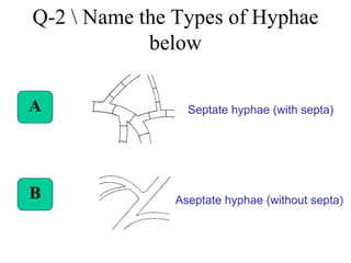 Q-2 Name the Types of Hyphae
below
A
B
Septate hyphae (with septa)
Aseptate hyphae (without septa)