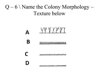 Q – 6 Name the Colony Morphology –
Texture below