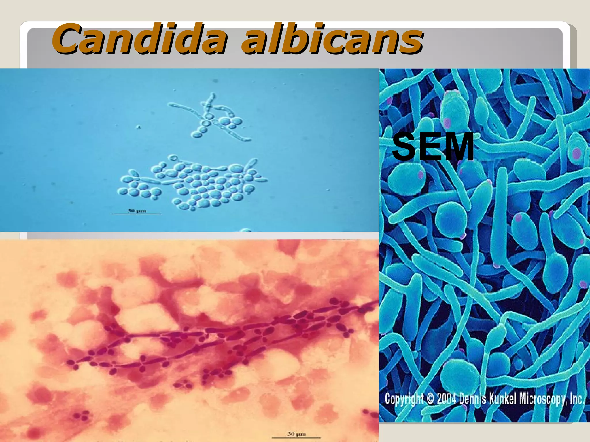 Candida albicans

              SEM
 