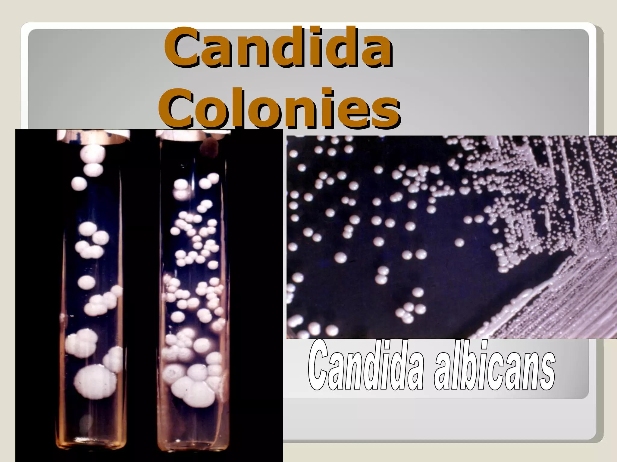 Candida
Colonies
 