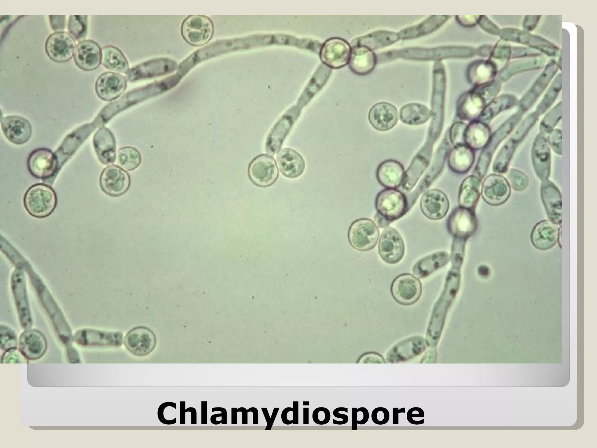 Chlamydiospore
 