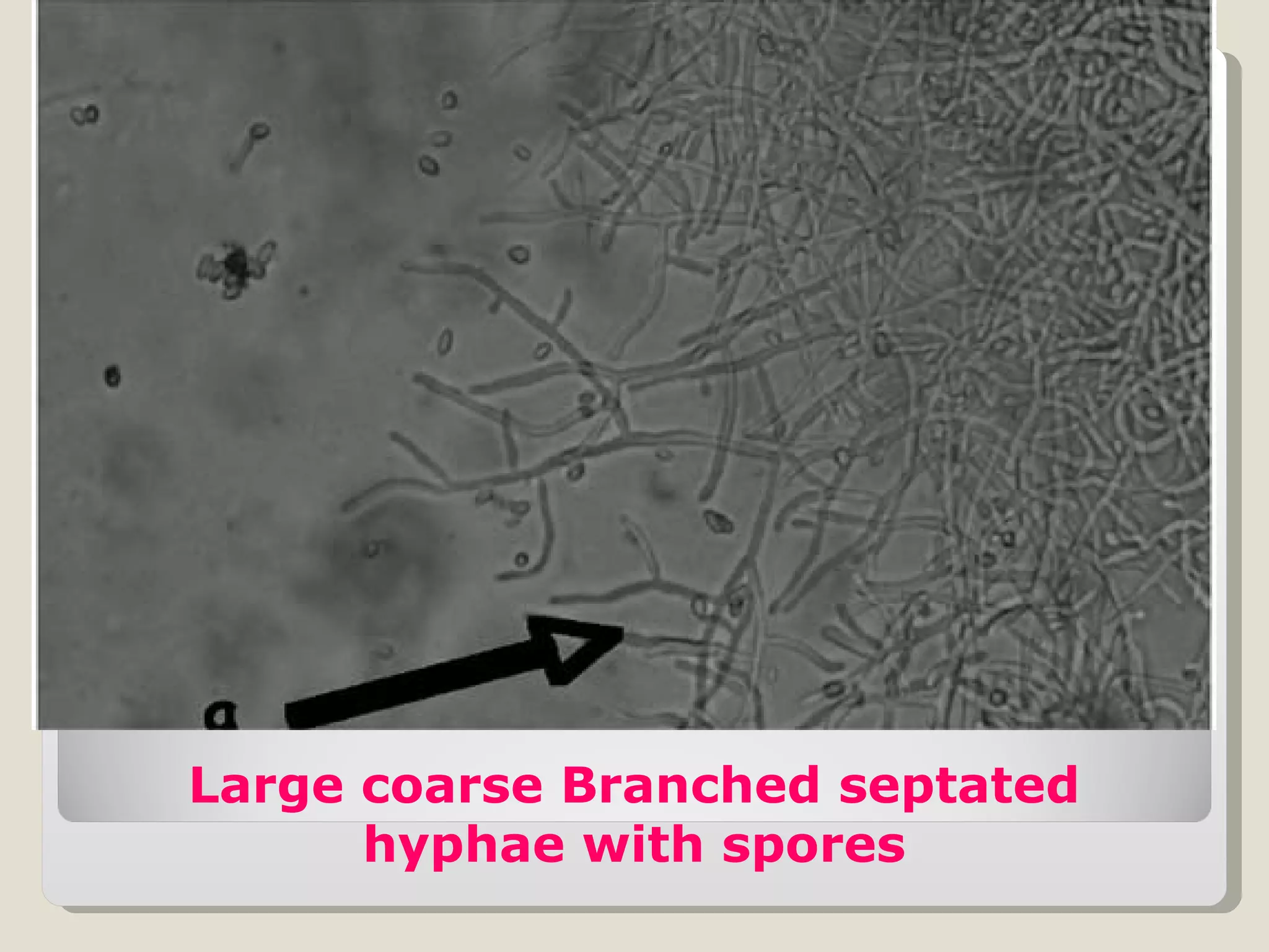 Large coarse Branched septated
      hyphae with spores
 