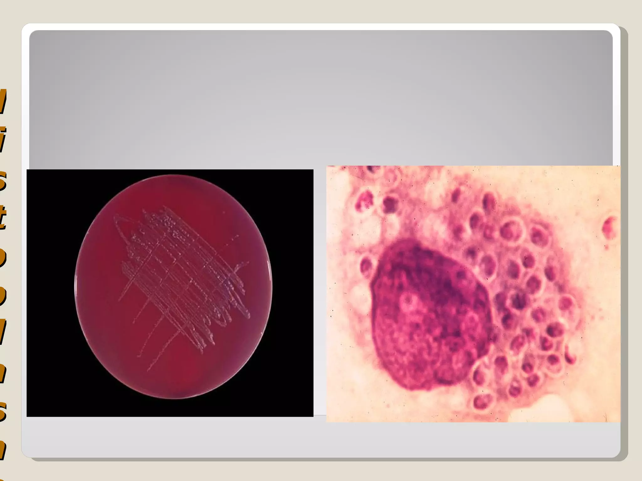 H
 i
s
 t
o
p
 l
a
s
m
 