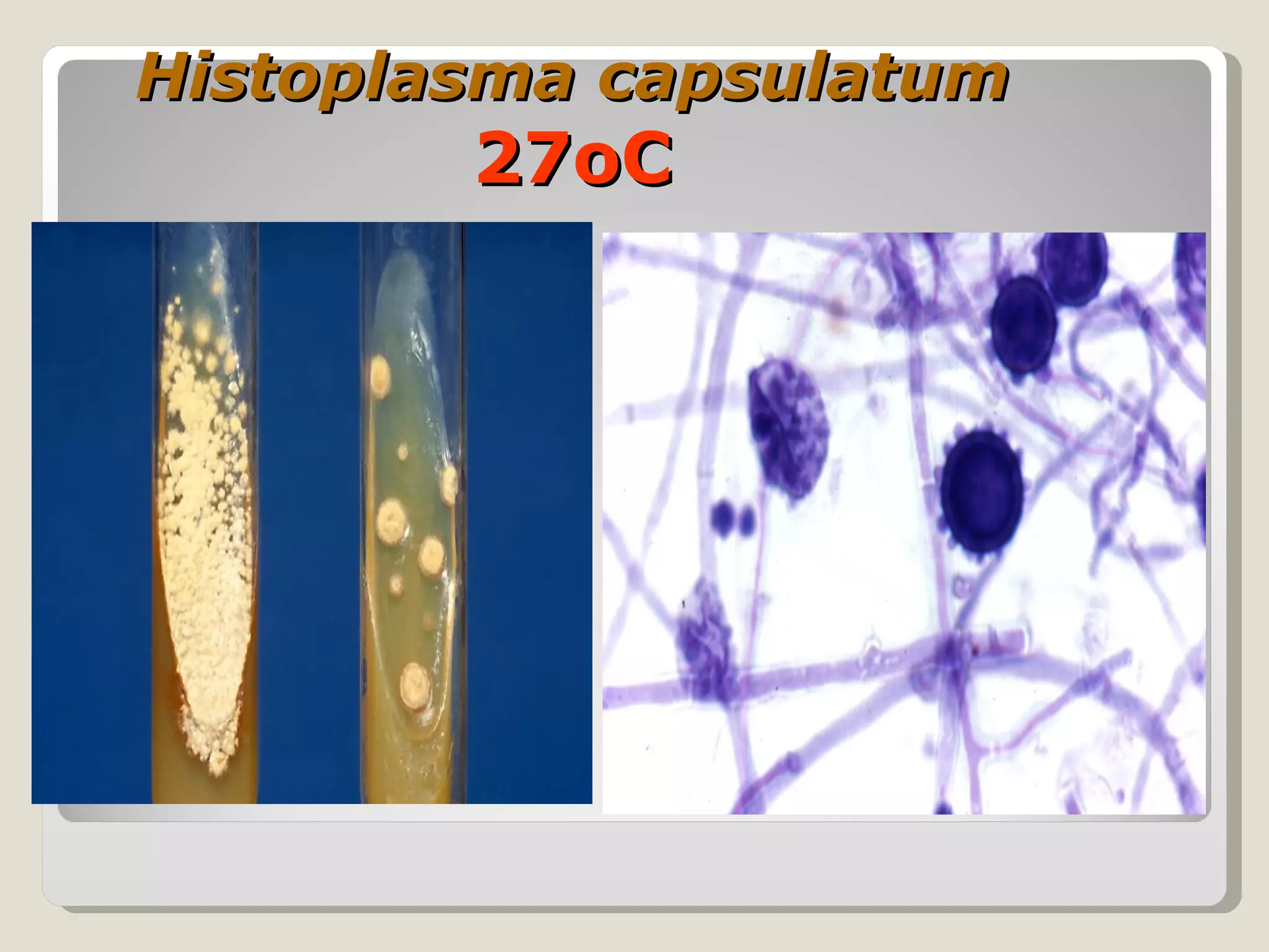 Histoplasma capsulatum
        27oC
 