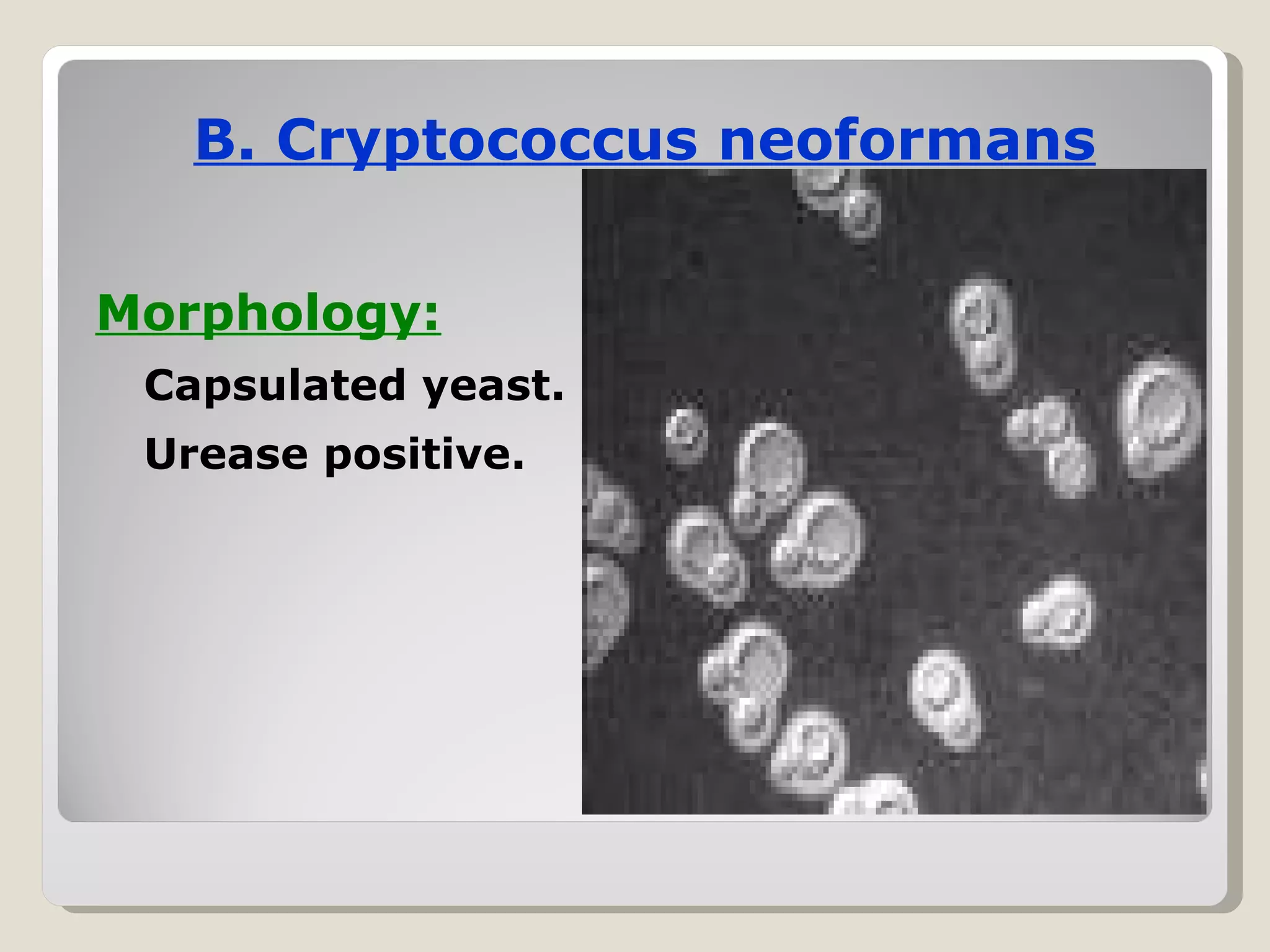 B. Cryptococcus neoformans


Morphology:
 Capsulated yeast.
 Urease positive.
 