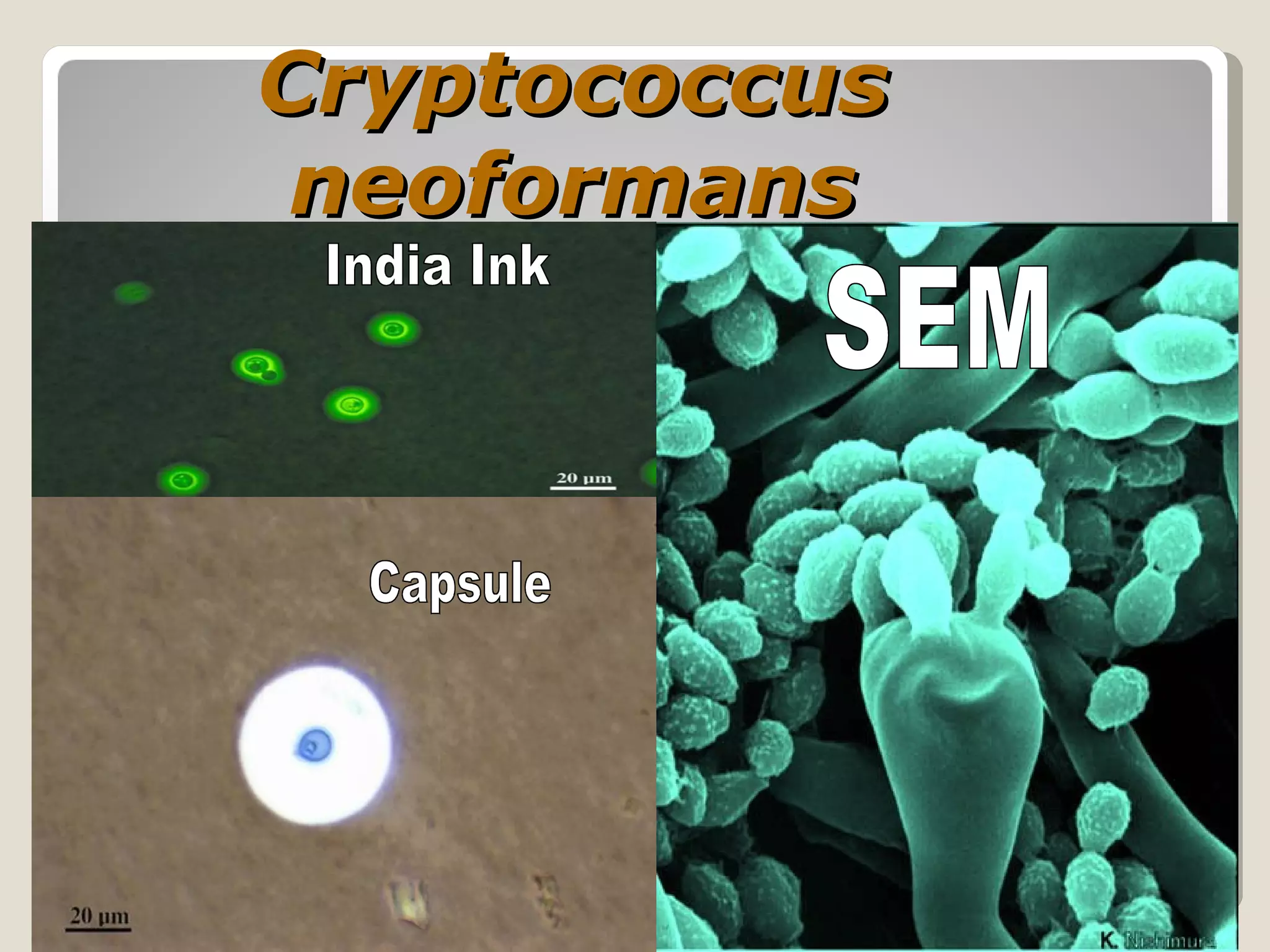 Cryptococcus
 neoformans
 