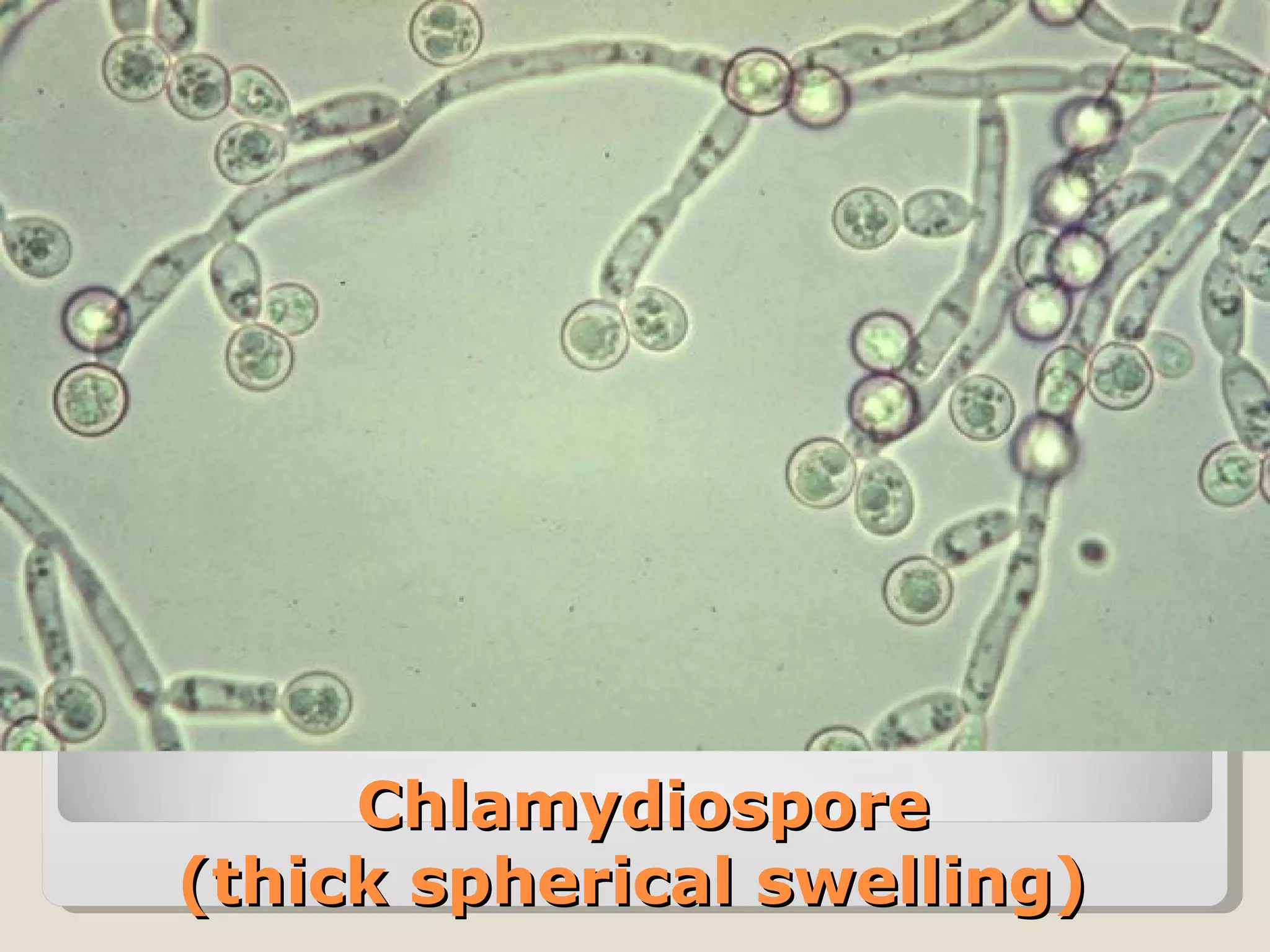 Chlamydiospore
(thick spherical swelling)
 